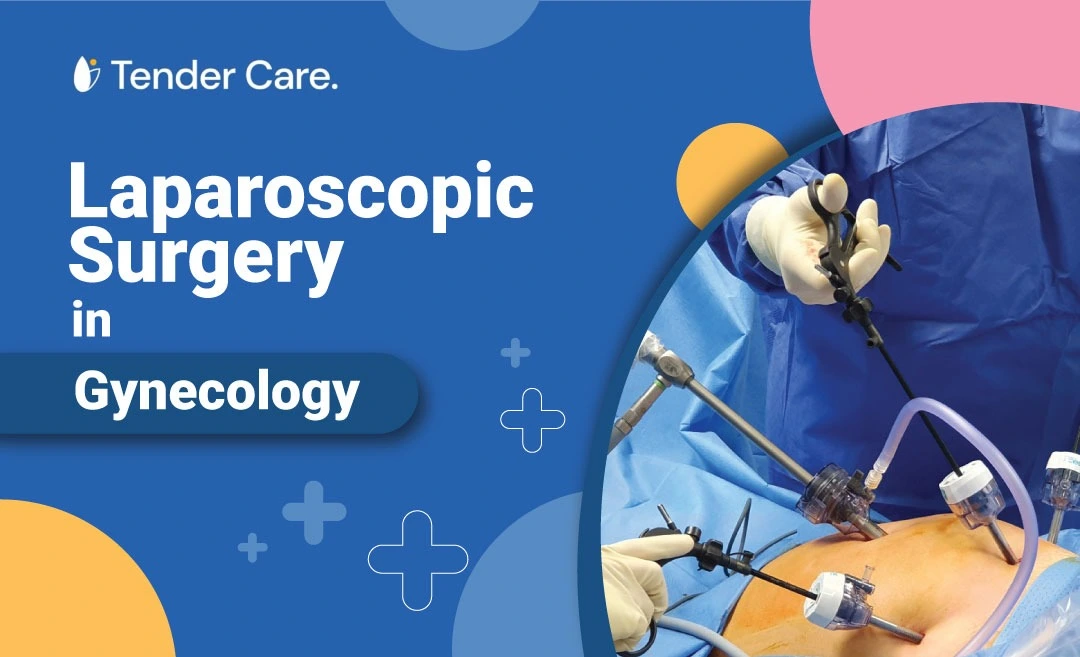 Laparoscopic Surgery in Gynecology
